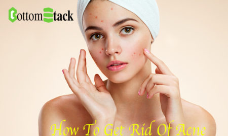 how to get rid of acne